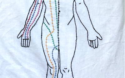 Acupuncture and chronic pain relief