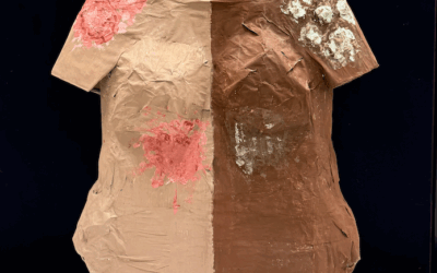 Skin Conditions: diagnostic inequalities