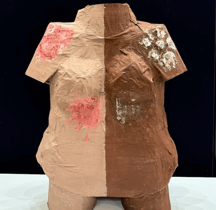 Skin Conditions: diagnostic inequalities