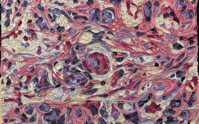 Prevention Under The Microscope