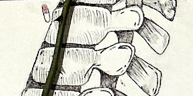Thorns